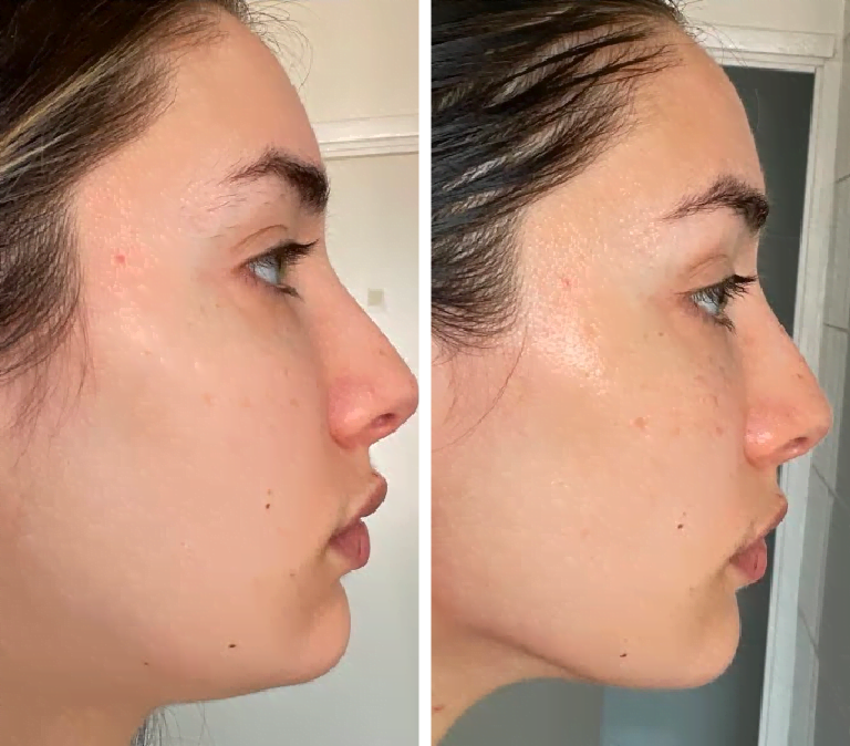 Gua Sha stone stainless steel