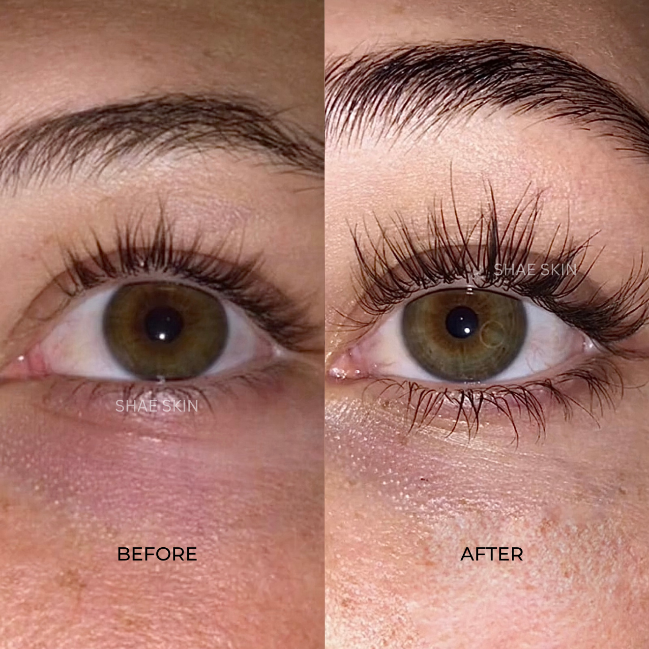 Eyelash Serum